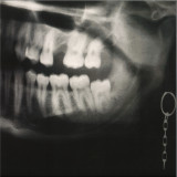 L.F.T. - Hollow Head (The Hacker Remix) LP