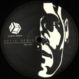 Optic Nerve - Time Lapse