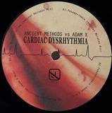Ancient Methods Vs. Adam X - Cardiac Dysrhythmia