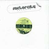 Undo - Despacio *remixes*