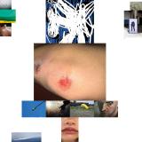 Remo Helfenstein - Spite LP