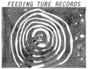 Feeding Tube